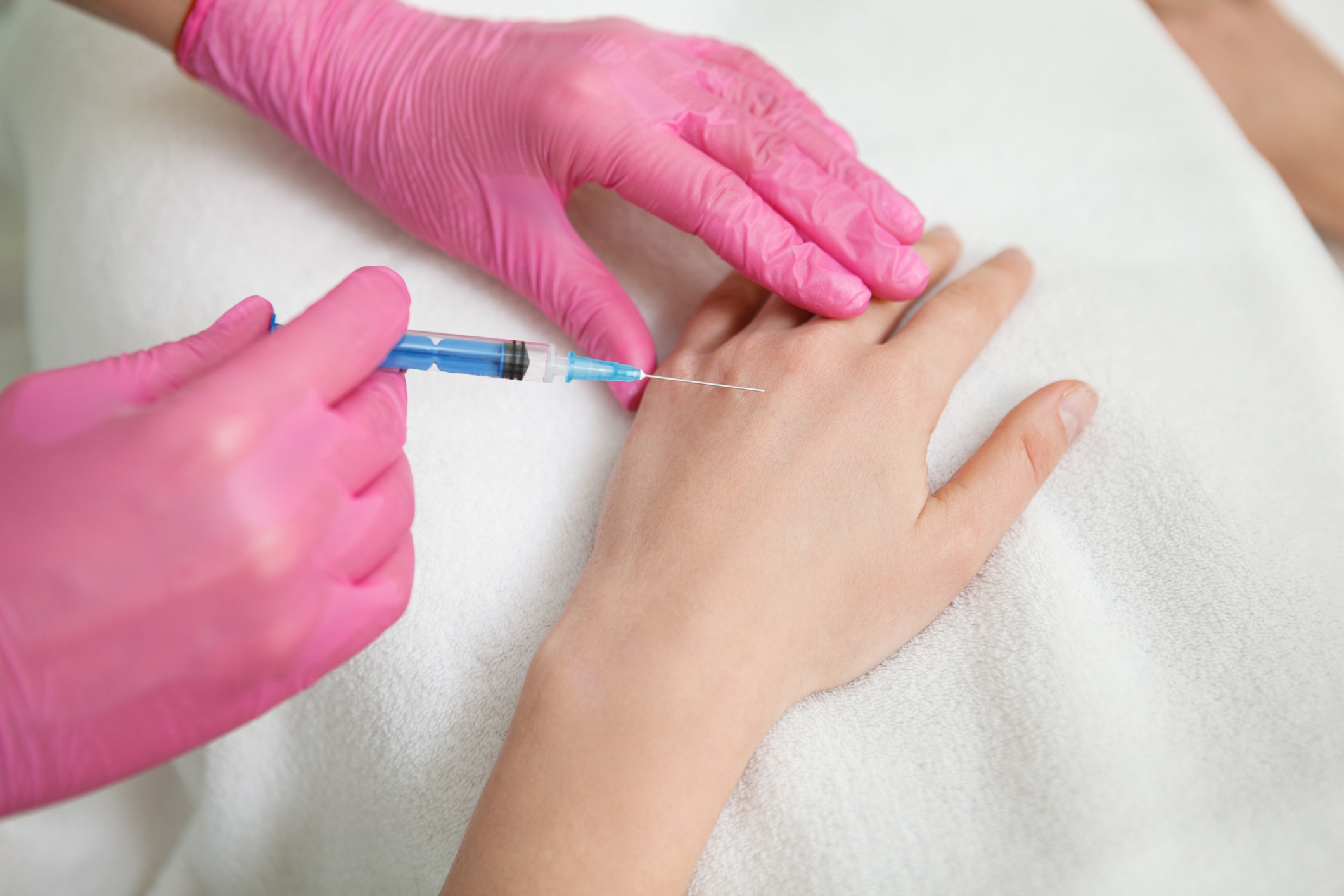 Hyaluronbehandlung zur Faltenunterspritzung Hyaluronbehandlung zur Faltenunterspritzung