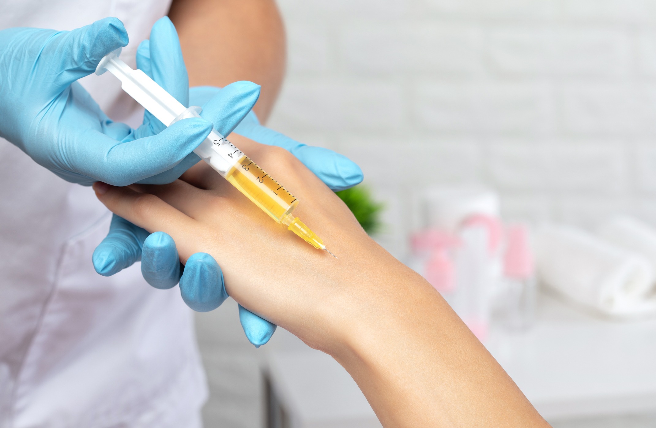 Faltenreduktion Hand mit Eigenblut (PRP) Düsseldorf Faltenreduktion Hand mit Eigenblut (PRP) Düsseldorf